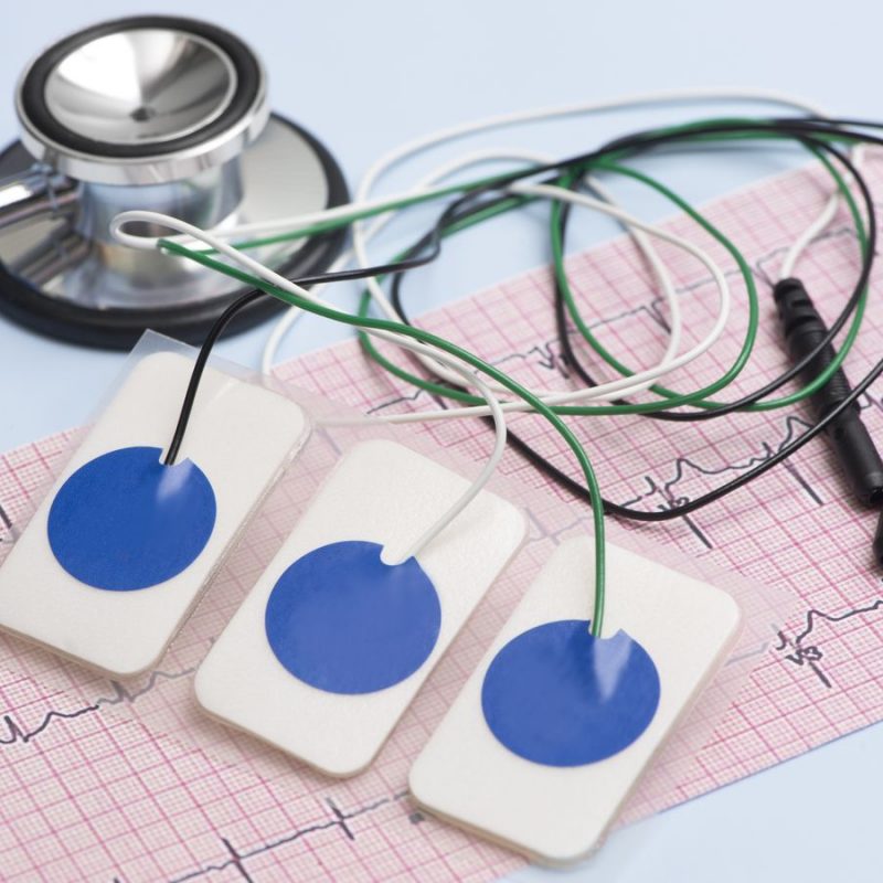 Modificări electrocardiografice la sportivi